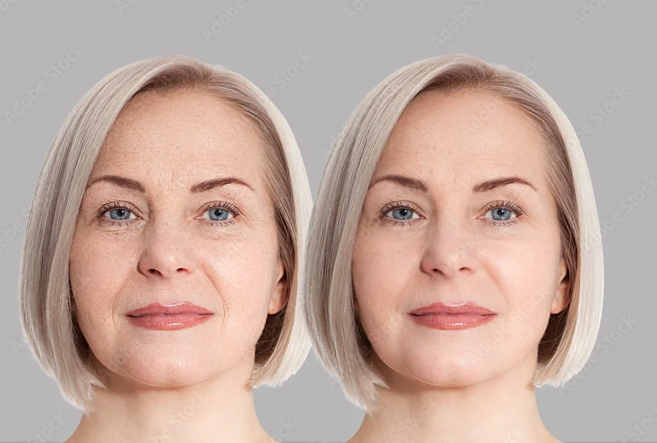 Essential Skin Care Tips to Prevent Ageing Before It Starts